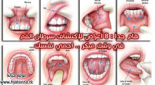 هام جدا 8 أعراض لاكتشاف سرطان الفم في وقت مبكر احمي نفسك الوطن