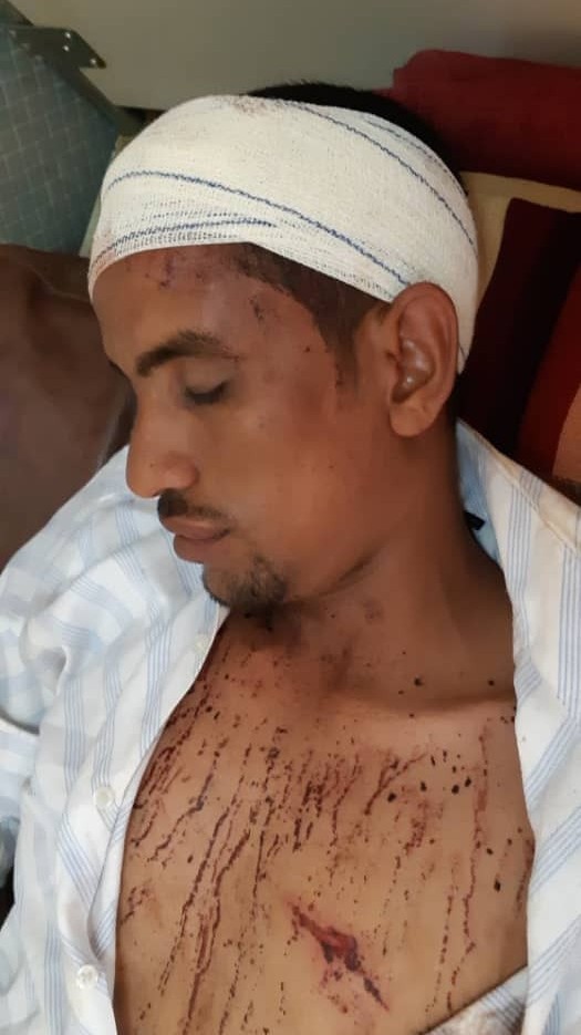 أحد المصابين في الصراع يرقد في مستشفى العيون عاصمة ولاية الحوض الغربي
