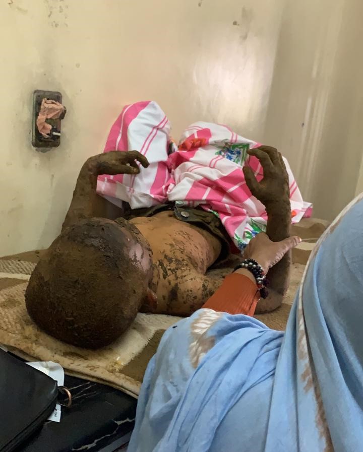 أحد الأطفال على سرير المستشفى بنواكشوط بعد 12 ساعة من انتظار العلاج